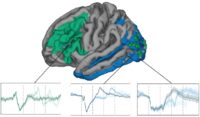 Map of brain with graphs of brain activity